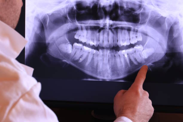 Best Emergency Dental Surgery in Winnetka, IL